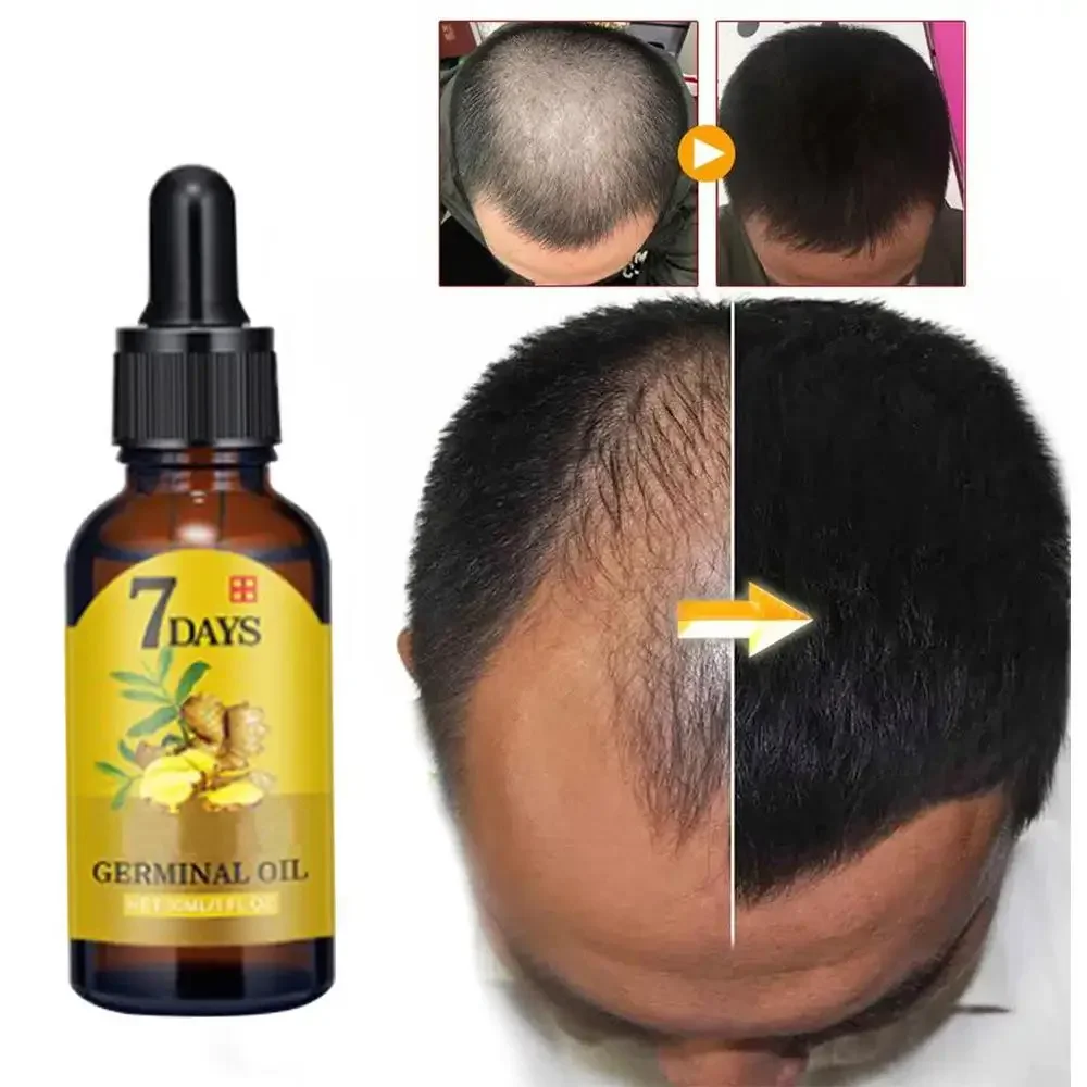Ingrown Hair Serum - Wzrost włosów Imbir Szybko rosnące włosy